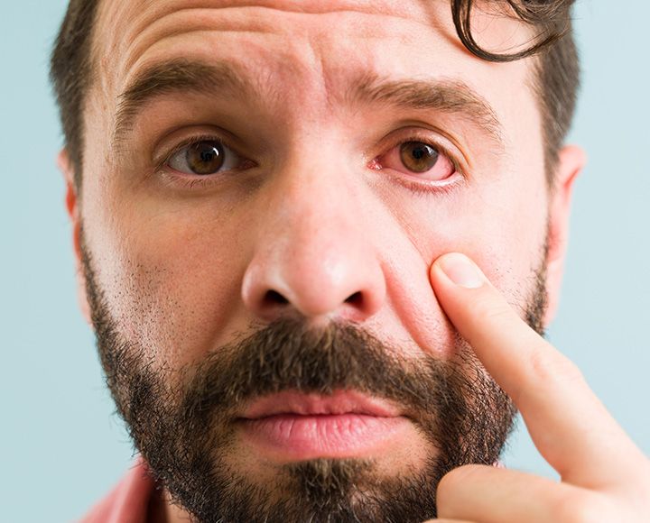 Integrate Into Ocular Surface Disease Management